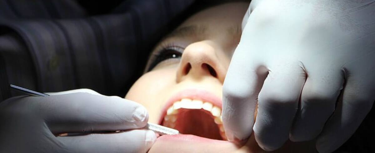 ¿Qué significa que se caigan los dientes? Te lo explicamos