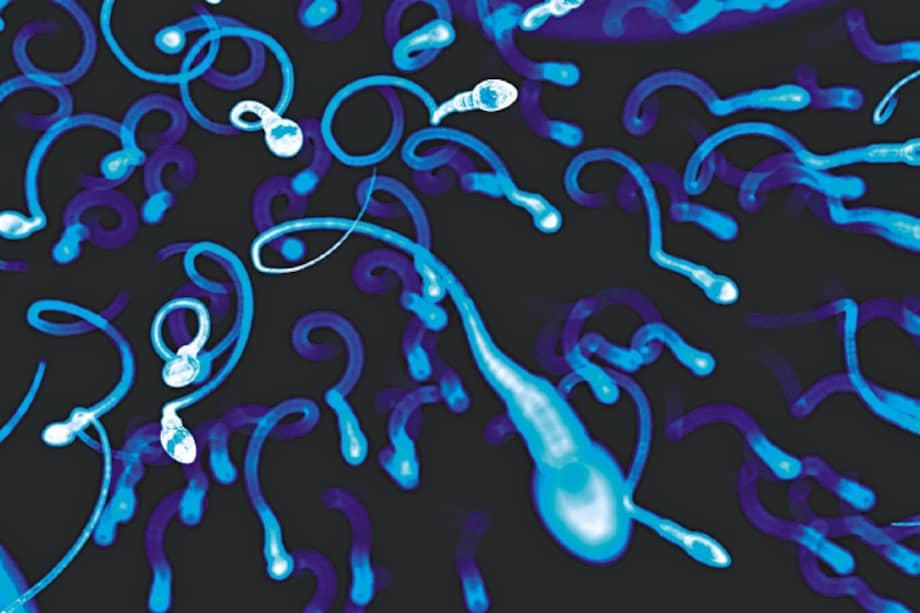 De la vasectomía a un gel anticonceptivo