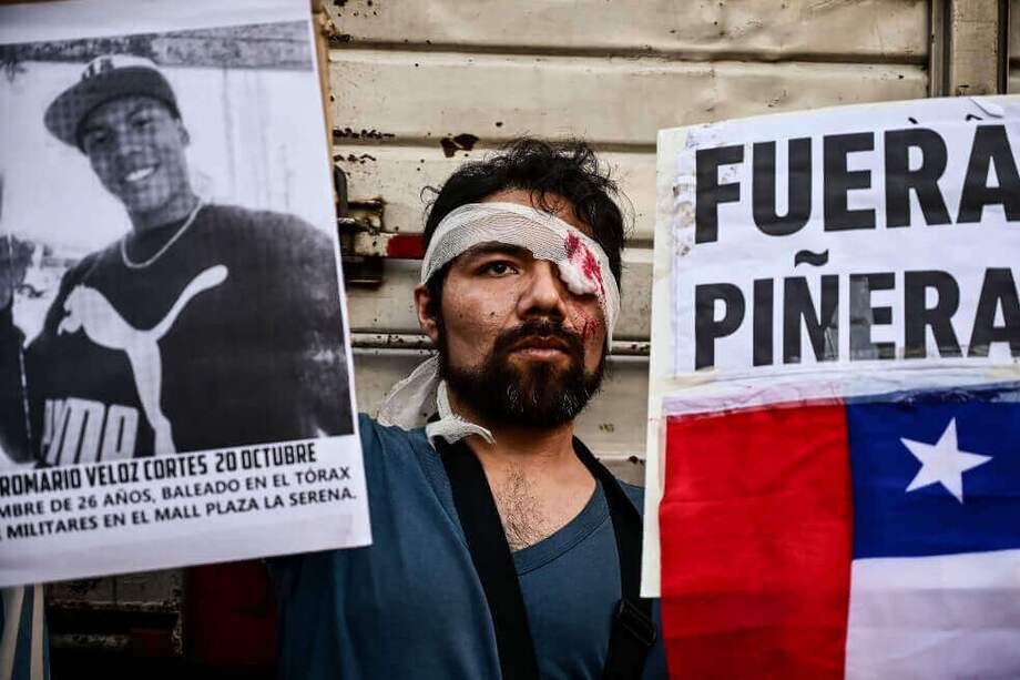Casi 200 personas en Chile han sufrido heridas oculares, causadas por perdigones disparados por las fuerzas de seguridad durante las manifestaciones sociales.
/ AFP