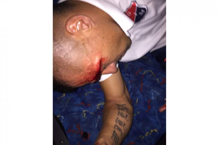 Vladimir Marín tras el incidente con el bus de Medellín. Foto: @Chuscosierra16