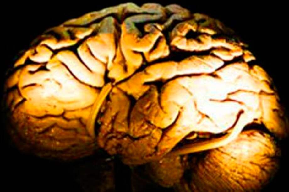 Sí existen las técnicas para olvidar / AFP