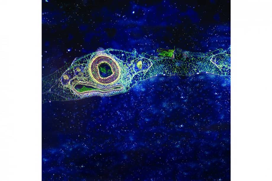 Imágenes microscópicas de una arteria, ojos y piel expuestos en la galería del Parque Explora. / Cortesía Explora