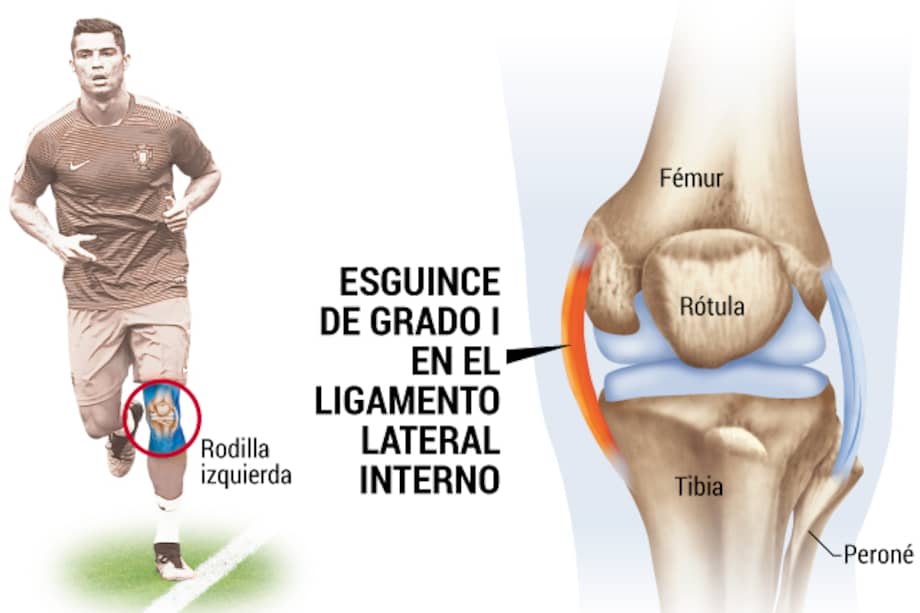Lesión en la rodilla de Cristiano Ronaldo.