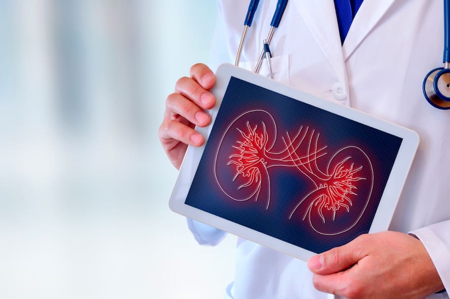 Tener piedras o cálculos en los riñones es algo un poco común, sin embargo, hay formas de evitarlo. Te contamos cómo.