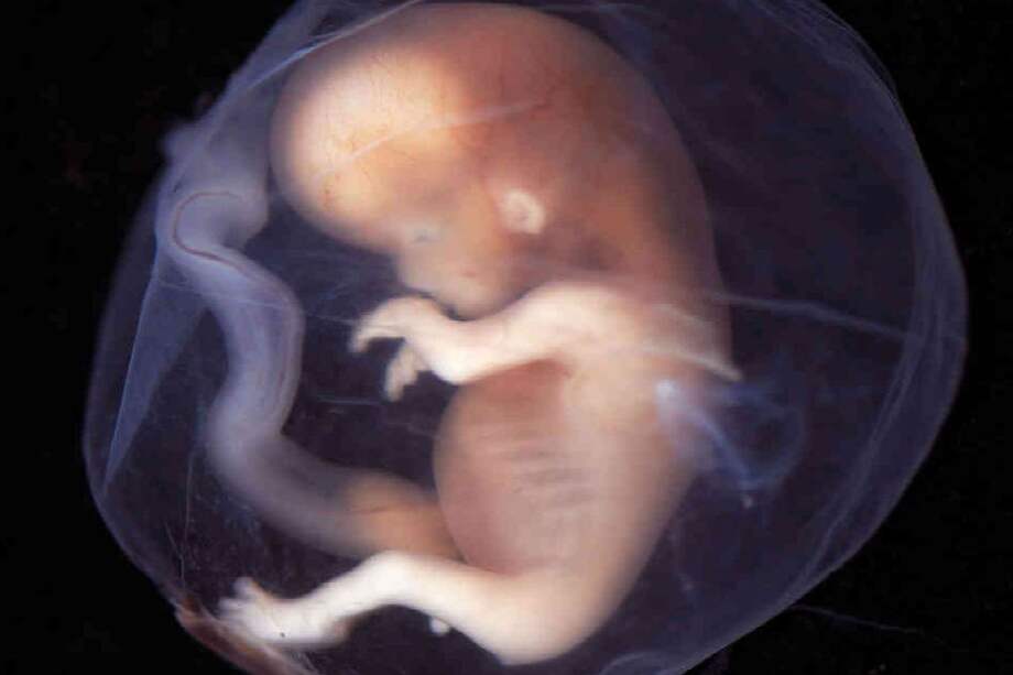 Embrión humano de aproximadamente 19 semanas. / SWRC.com