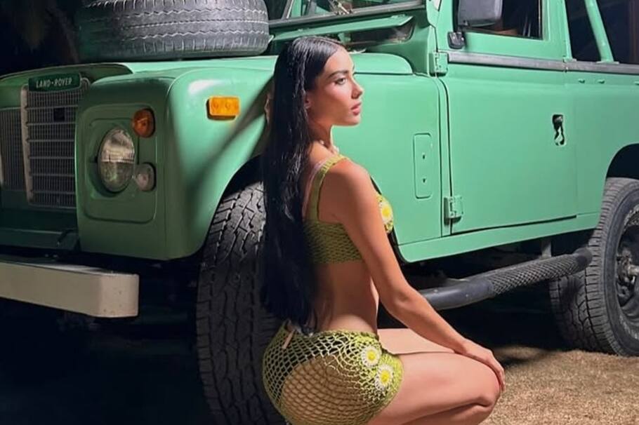 Realmente, la modelo de 23 años tiene una rara condición médica con la que viene luchando desde hace diez años.