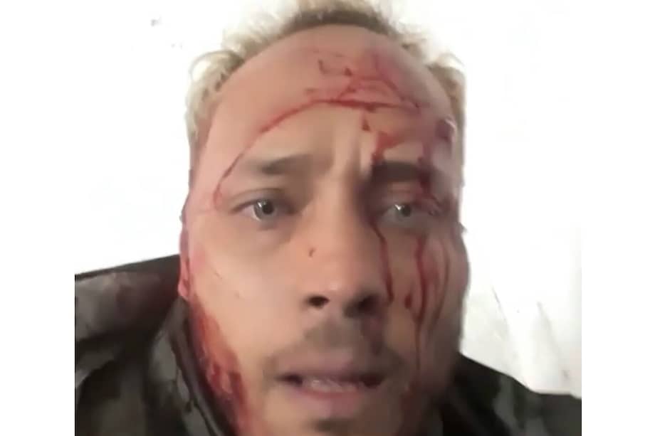 En quince videos que difundió en Instagram durante el operativo, el piloto había acusado a las autoridades de querer matarlos usando lanzagranadas, pese a que querían entregarse.