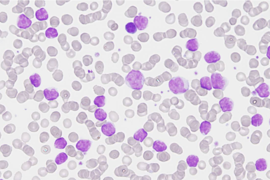Es el primer mapa detallado de los efectos de esta enfermedad.