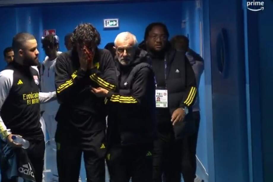 Fabio Grosso, entrenador de Lyon, herido tras los incidentes protagonizados por los hinchas de Marsella.