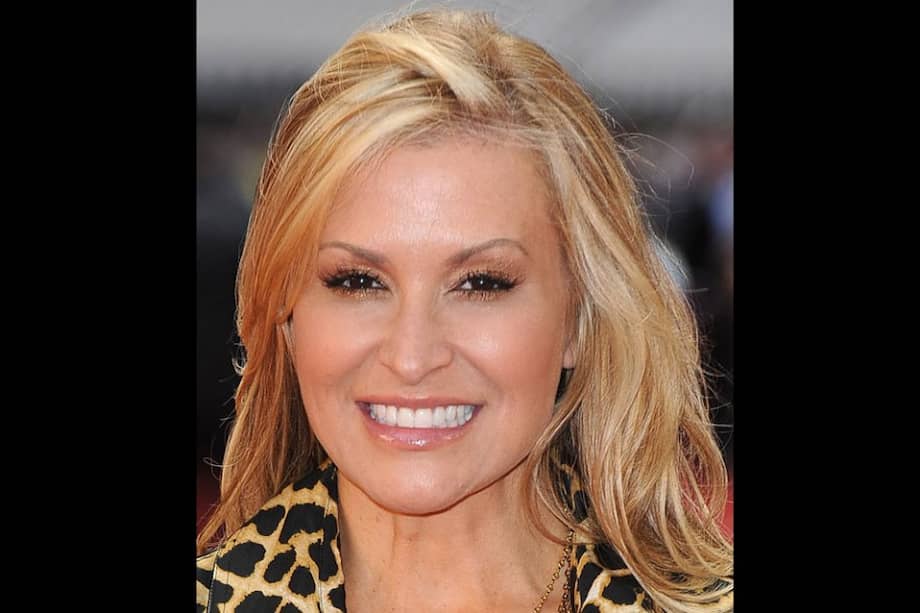 La cantante Anastacia.