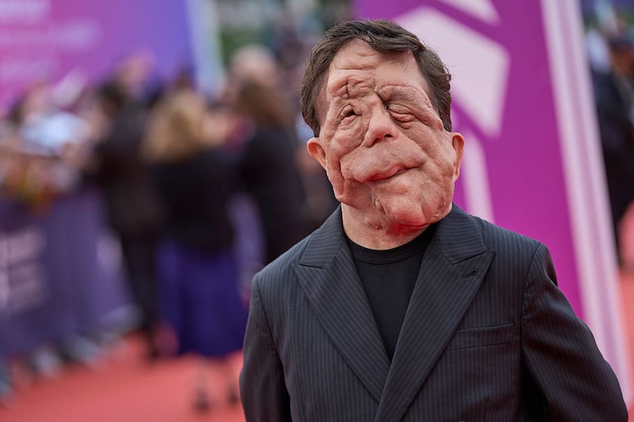 Recordado por su papel en la película ‘Under The Skin’, el actor de 39 años se ha sometido a más de 30 cirugías estéticas y ha sobrevivido al odio y al rechazo por su rostro desfigurado. Esta es su historia.