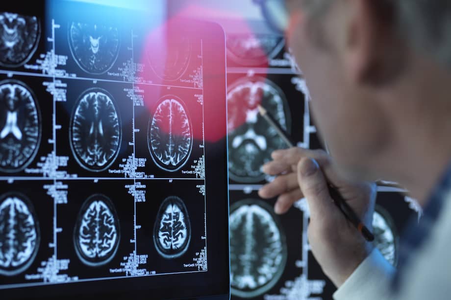 No todos los tumores cerebrales son cancerosos, pero todos requieren valoración médica para determinar su naturaleza y tratamiento.
