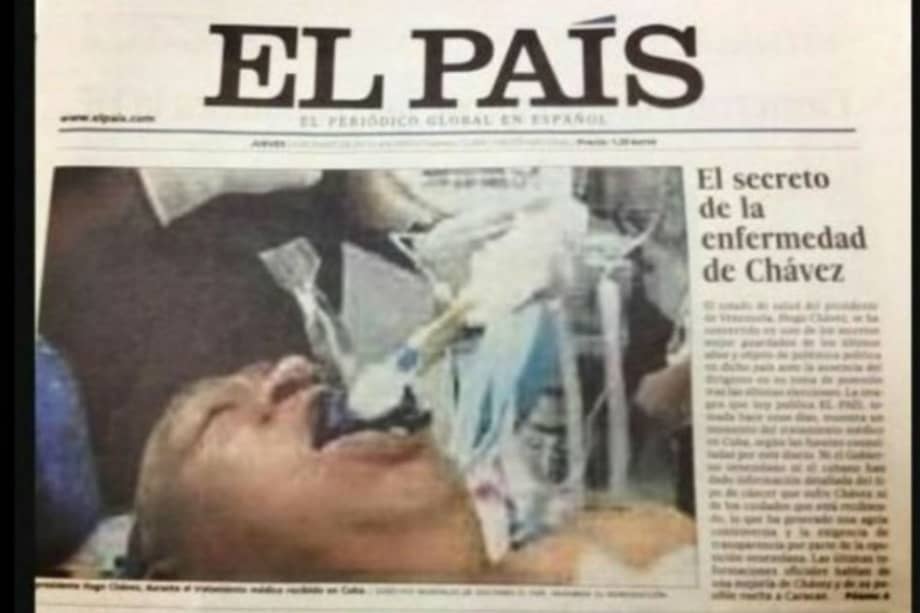 Foto que publicó diario español de Hugo Chávez intubado es falsa