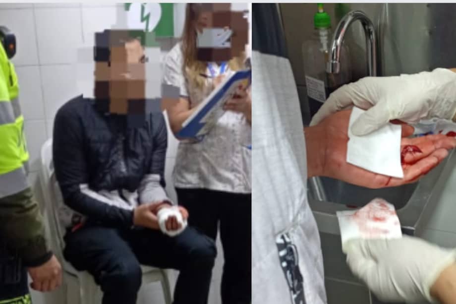 Intentó colarse y salió mal: se lastimó la mano al tratar de evadir el pago de TM.