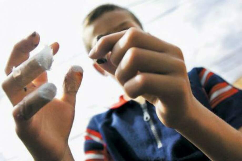 Cinco menores quemados con pólvora en lo corrido de Semana Santa