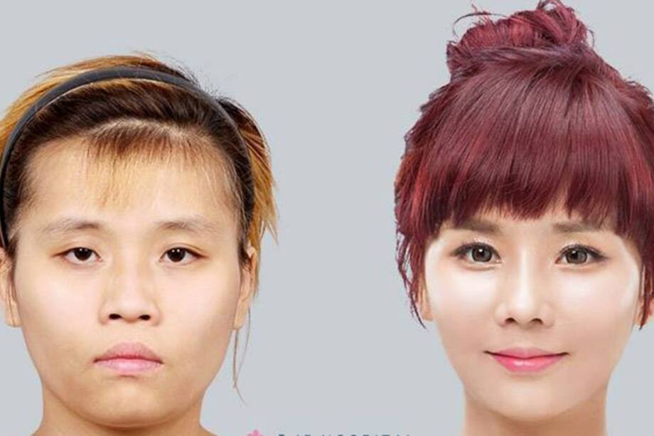 A punta de cirugías, reality convierte en ‘princesa’ a una joven surcoreana