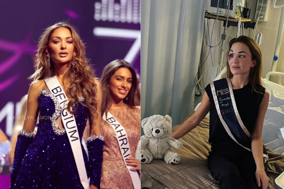 Miss Bélgica tuvo un grave accidente automovilístico y compartió varias imágenes de su recuperación.