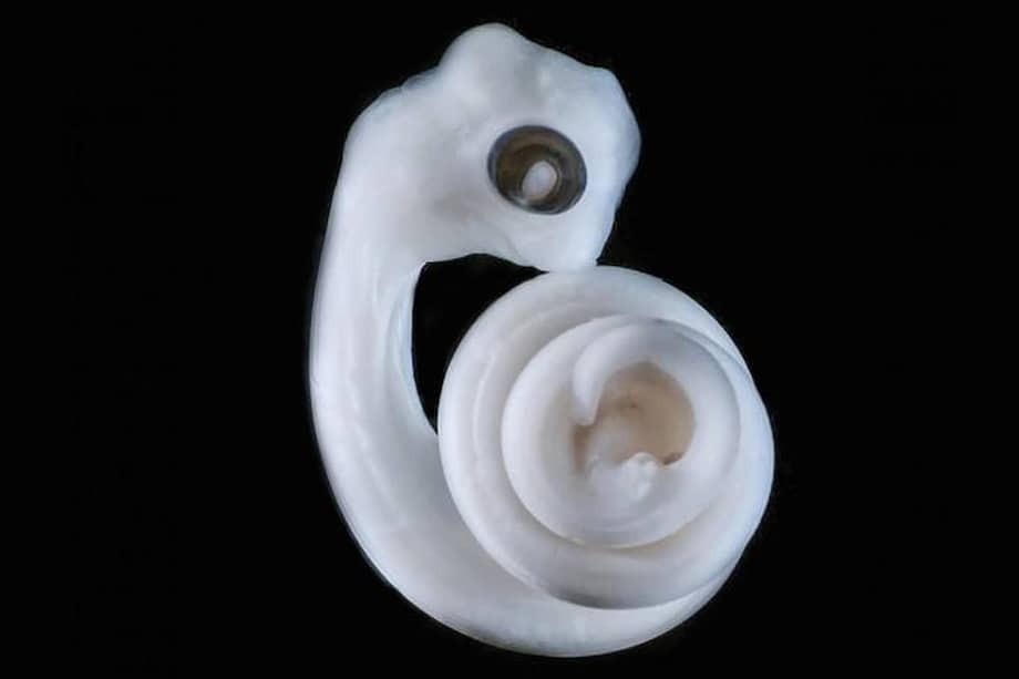 En el lugar donde estarían las piernas, si las serpientes las tuvieran, surgen unos minúsculos brotes que se convertirán en los hemipenes de este embrión. / Patrick Tschopp, Harvard Medical School