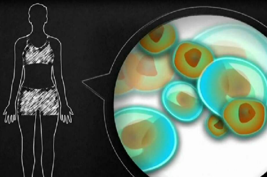 Un nuevo fármaco retrasa la progresión de la esclerosis múltiple primaria