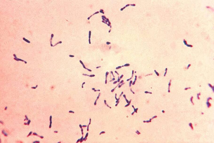 ¿Puede la evolución de las bacterias ser predecible o no? Un estudio internacional habló del tema y dio los resultados.