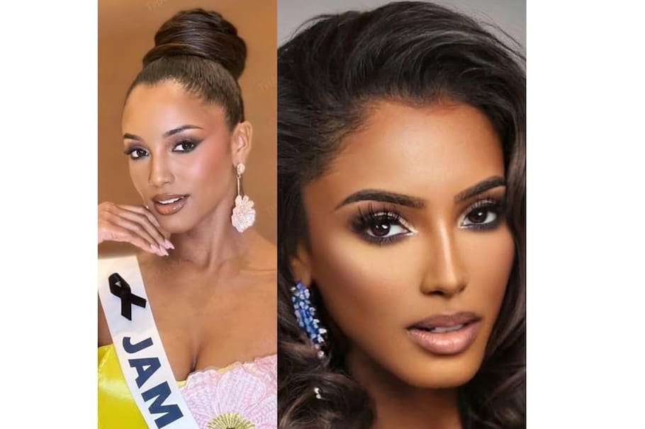 Este es el último parte médico de Miss Jamaica: “hemorragia intracraneal”