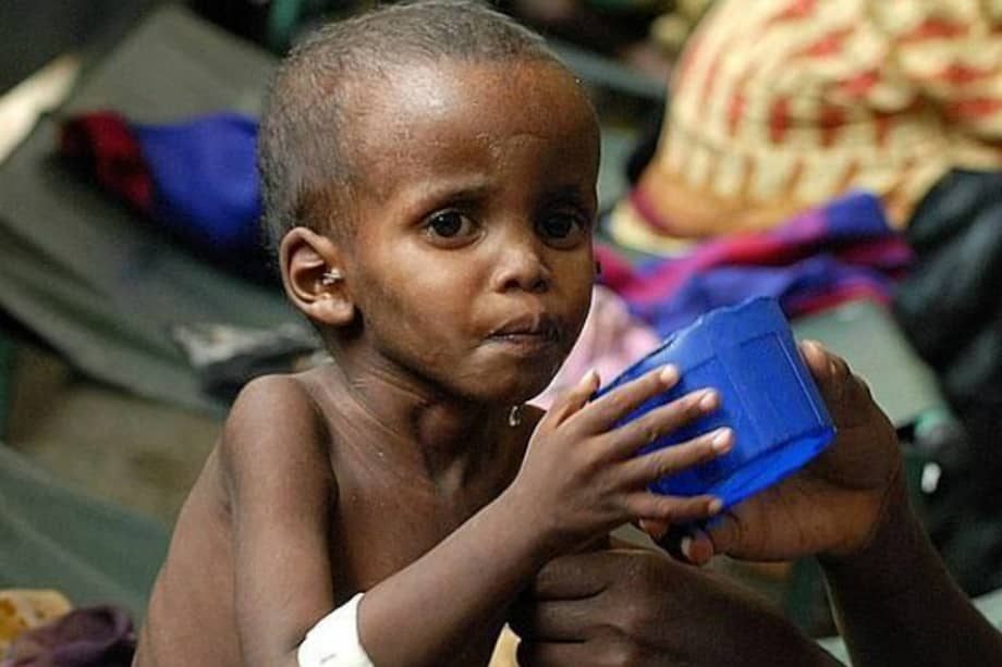 Malnutrición crónica, uno de los factores que afectan a la población infantil. / AFP