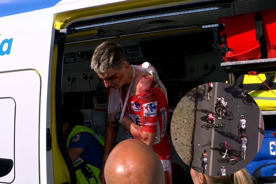 Tadej Pogacar tuvo que ser retirado de la carrera en ambulancia.