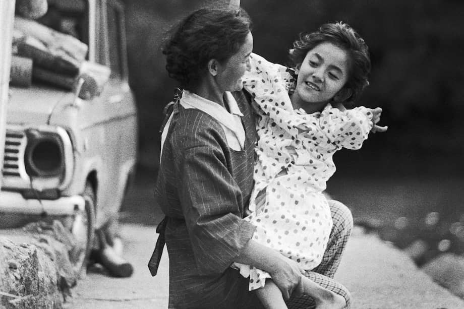 Una paciente con enfermedad de Minamata fetal y su madre.