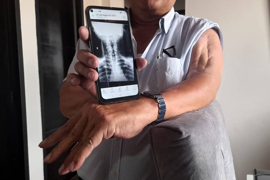 José Adelín Rodríguez enseña la radiografía en la cual se ve cómo una bala quedó incrustada en su nuca.