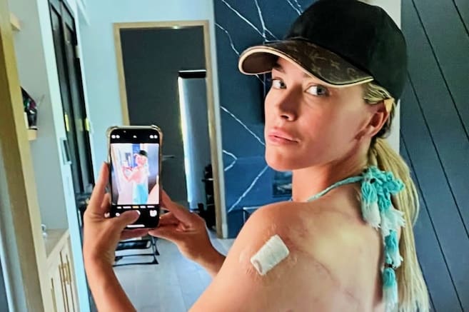 Teddi Mellencamp comparte un nuevo y preocupante informe sobre su salud después de múltiples operaciones