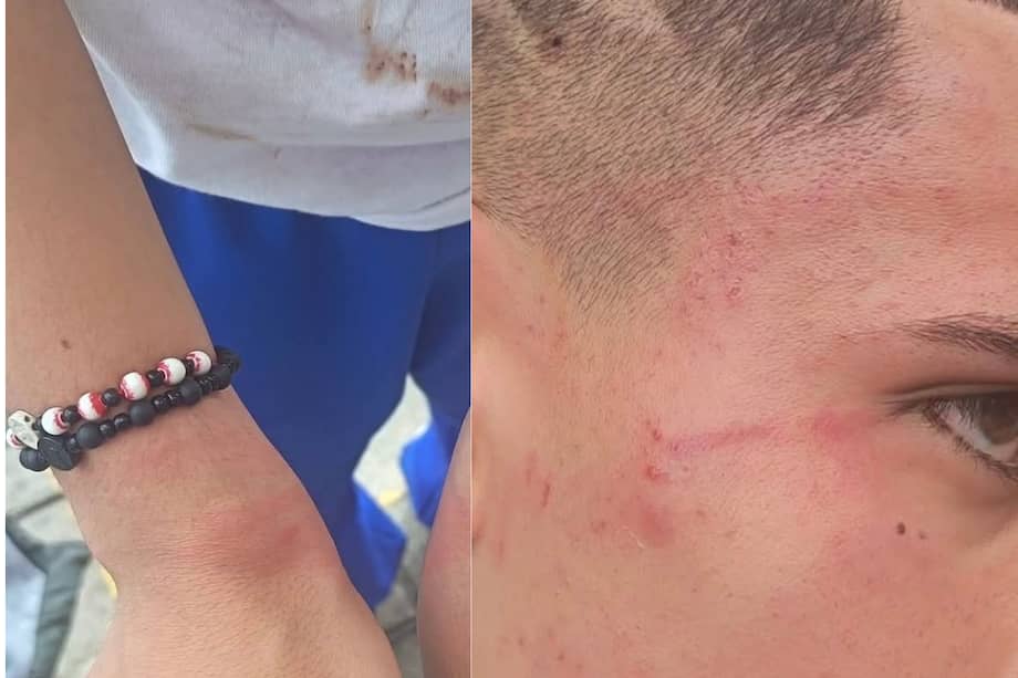 Estudiante denuncia que fue esposado y agredido en un CAI.