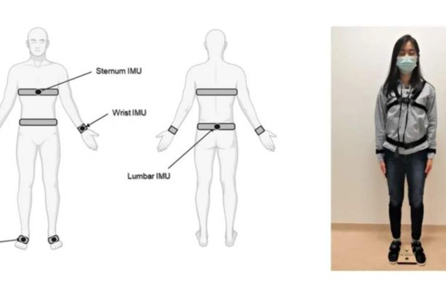Los sensores portátiles proporcionan una detección temprana de la progresión de la enfermedad de Parkinson. /Universidad de Oxford