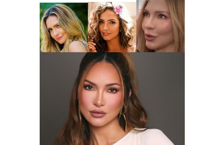 Las dos primeras imágenes (en la parte superior) corresponden a Kimberly hace un tiempo; la tercera y la inferior a cómo luce la actriz ahora. ¿Qué se hizo? es la pregunta de los cibernautas