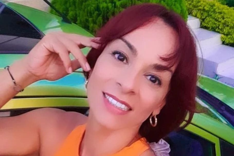 La actriz Endry Cardeño se mostró afectada por el estado actual de sus piernas tras un procedimiento estético. ¿Qué le pasó?