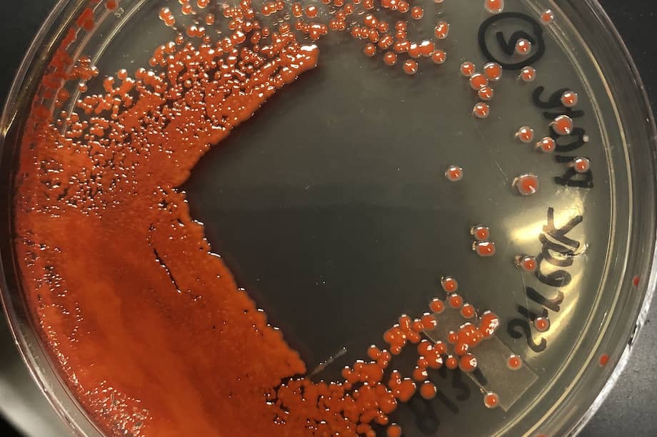 Imagen de la bacteria "Serratia marcescens" en una caja de petri.