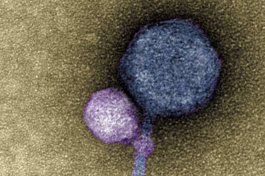 Una imagen coloreada del virus satélite recién descubierto que se adhirió a su virus auxiliar.