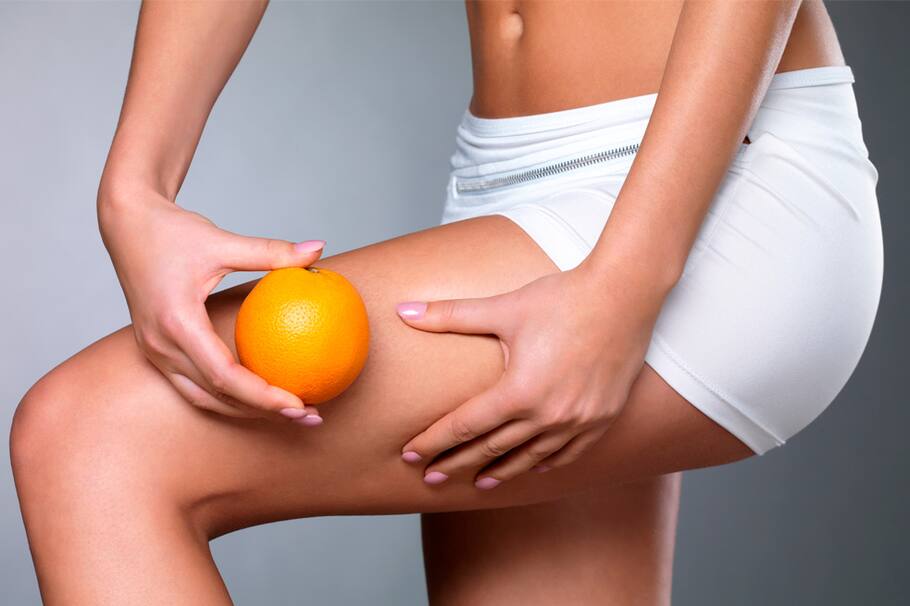 Algunos alimentos pueden empeorar la presencia de celulitis al contribuir al almacenamiento de grasa y la retención de líquidos.