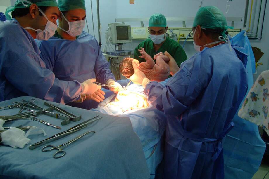 Uno de cada dos niños en el país nace por este procedimiento. / Santa Rosa Old Skool