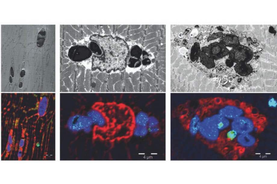 La mioglobina, la proteína responsable del color rojo de los músculos, tiene como función principal el transporte y el almacenamiento intracelular de oxígeno. / IDIBELL
