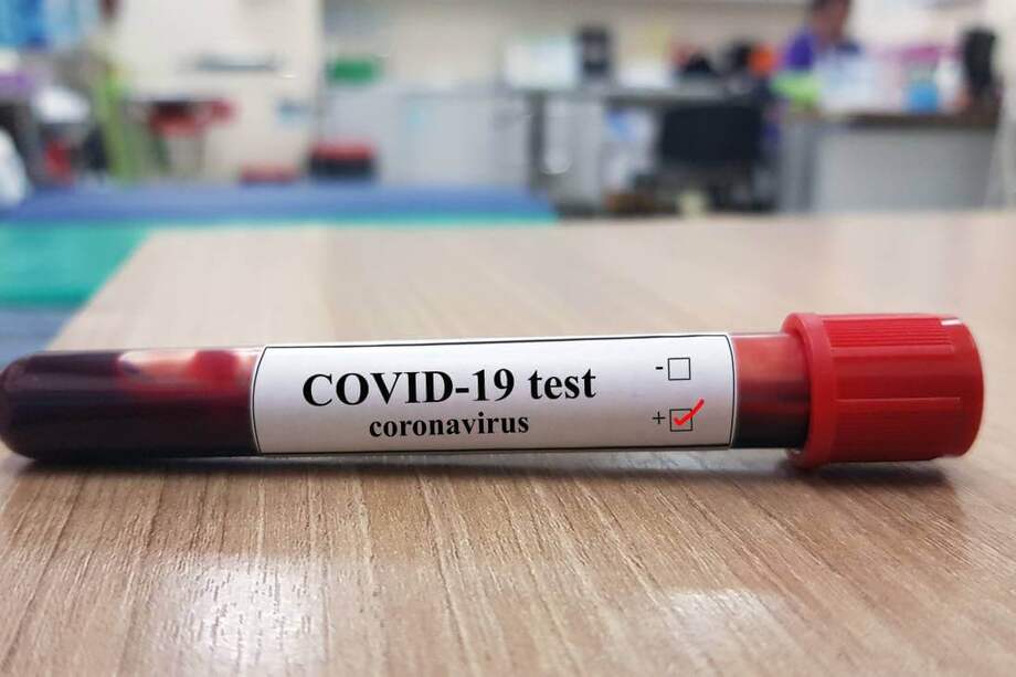 La OMS bautizó a la enfermedad provocada por el nuevo coronavirus como COVID-19, nombre que no se refiere a una ubicación geográfica, un animal, un individuo o un grupo de personas. / SINC