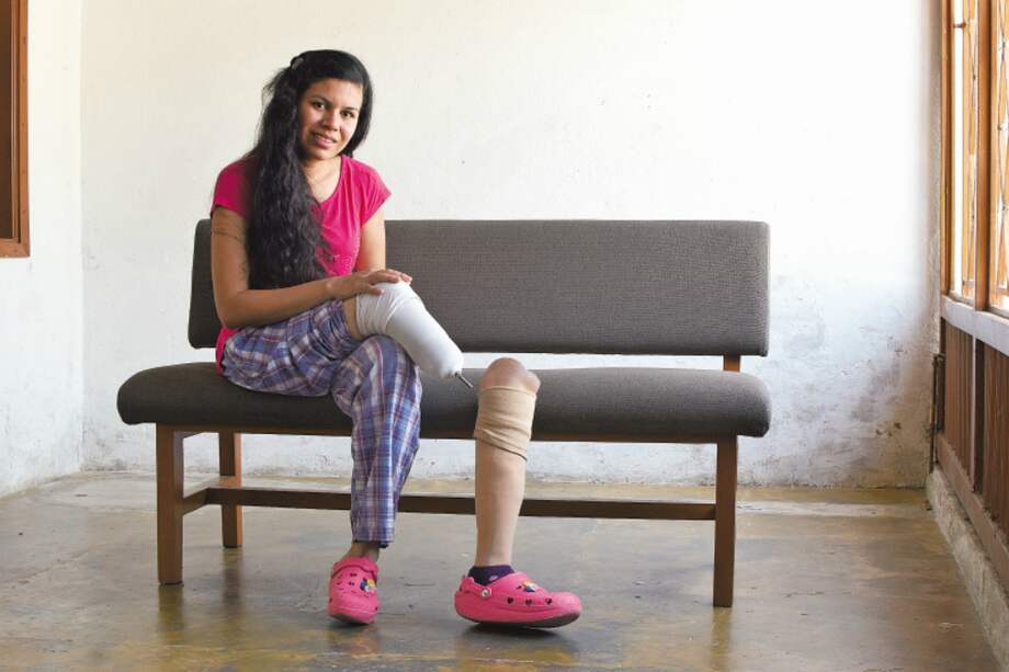 Mileyni Ramírez tenía 13 años cuando perdió una pierna por una mina antipersonal. / Unidad para las Víctimas