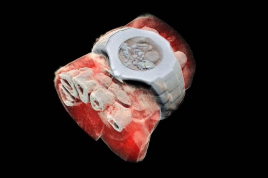 La tecnología funciona como una cámara. / MARS BIOIMAGING LTD)
