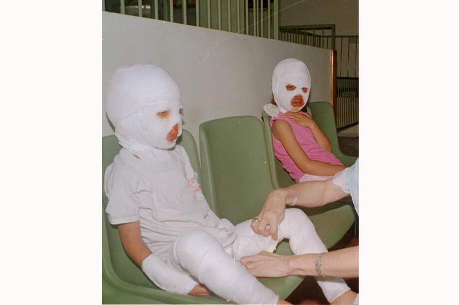 En Bogotá, dos niños resultaron quemados con pólvora manipulada por adultos. / El Tiempo