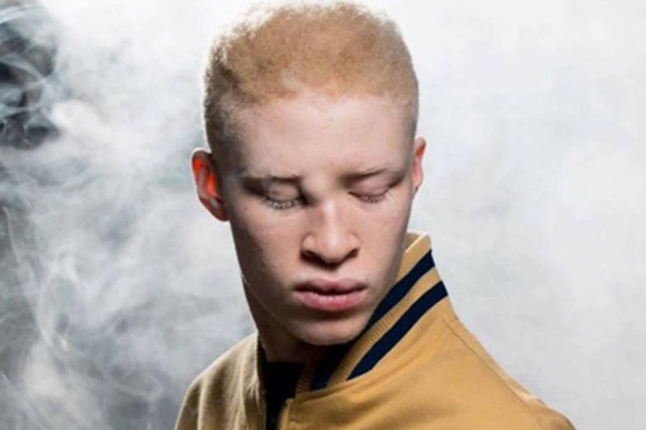 Shaun Ross, el primer albino en pisar una pasarela