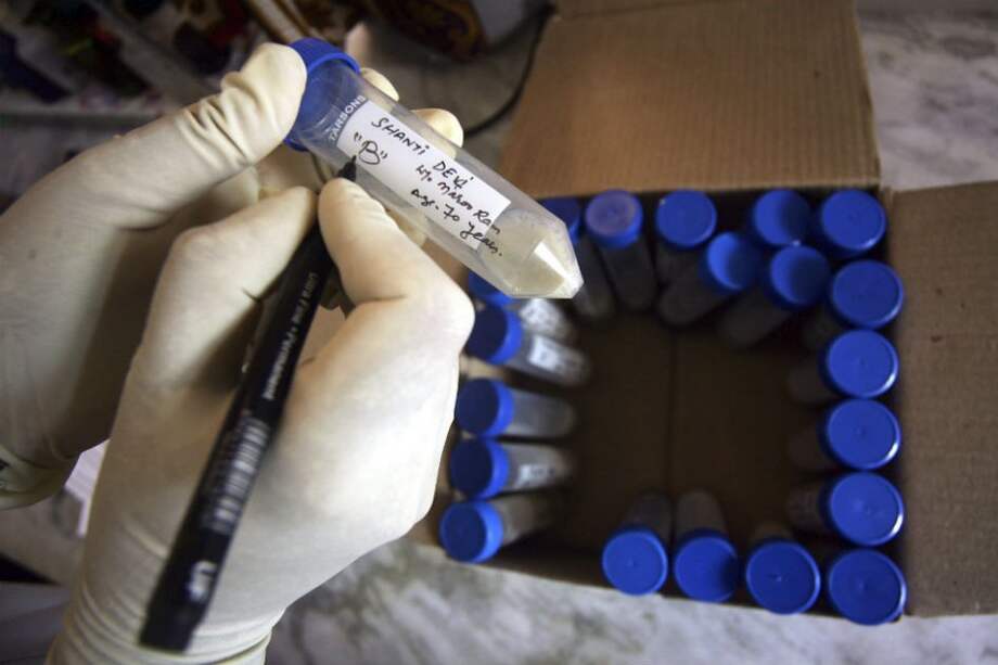 Tres millones de personas ignoran que tienen tuberculosis