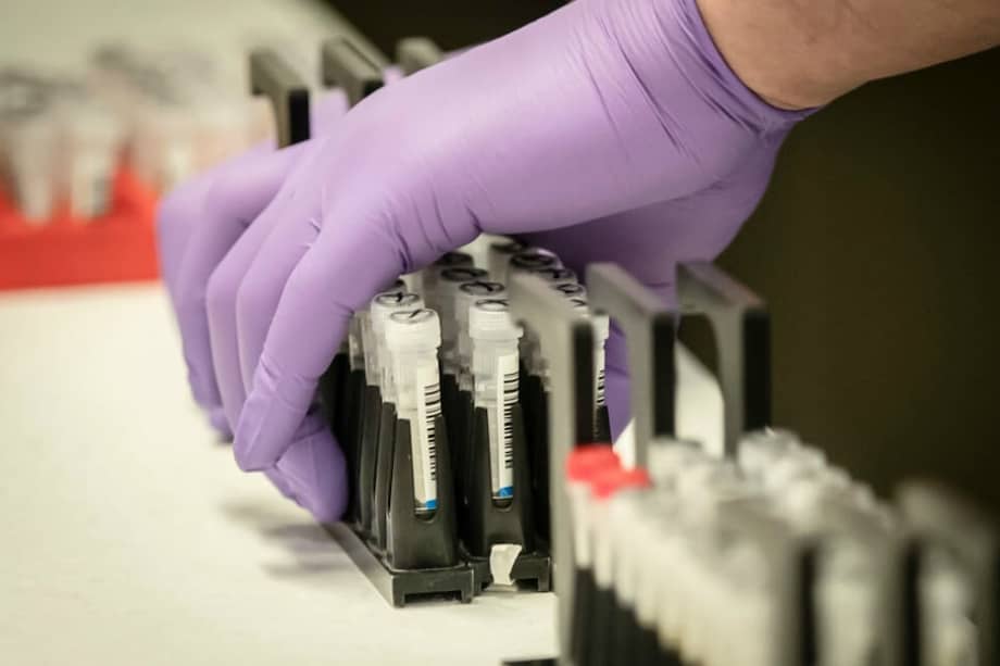 Ante estas inconsistencias, el Ministerio de Ciencias declaró a mediados de septiembre la no renovación del contrato hasta tanto no se presentaran los soportes financieros solicitados.