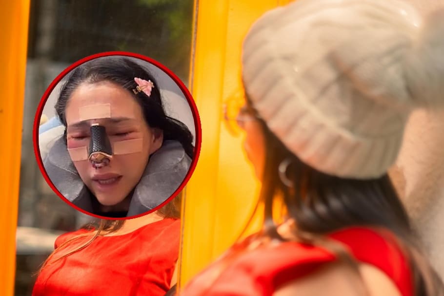 La también creadora de contenido se sometió a una nueva intervención quirúrgica para corregir las secuelas que afectaron su rostro. Así se ve actualmente.