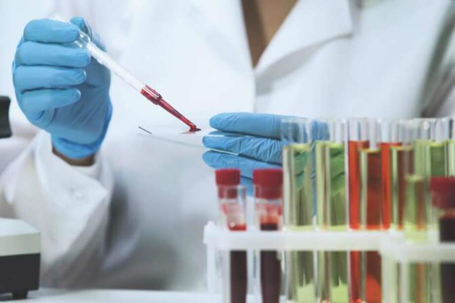 En 2017, Colombia reportó 13.310 casos nuevos de VIH, con 108 de ellos importados de otros países. / Getty Images