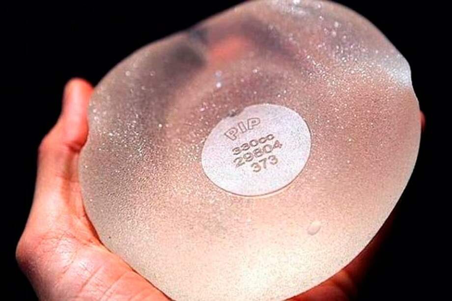 Implantes mamarios PIP (Poly Implant Prothèse). / EFE