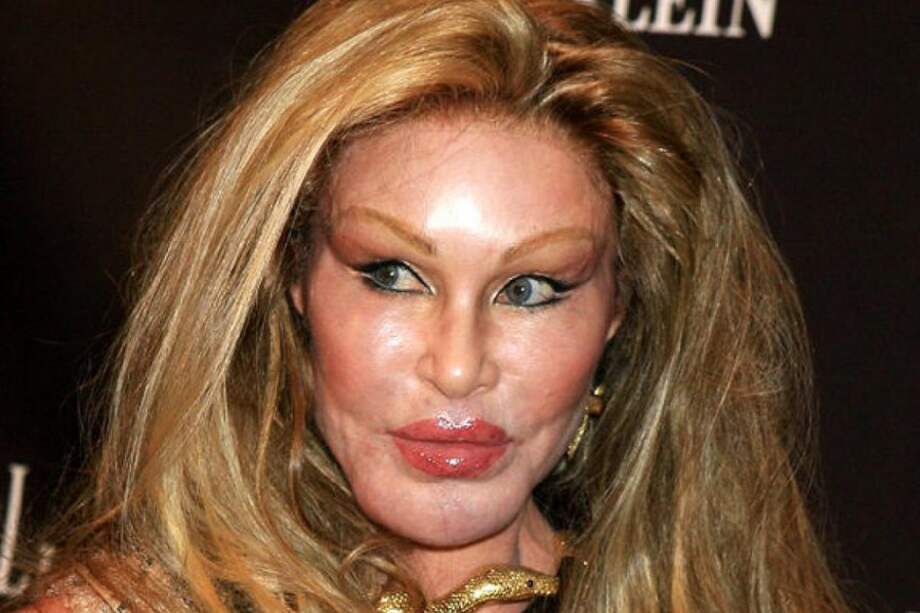 Jocelyn Wildenstein,se realizó varias cirugías para lograr una apariencia felina. / Celebrityabc - Flickr